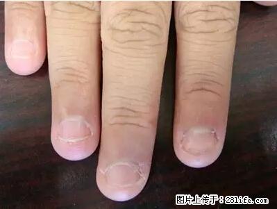剪指甲、挖耳屎，这些日常小动作竟隐藏大危害！ - 吐鲁番生活资讯 - 吐鲁番28生活网 tlf.28life.net